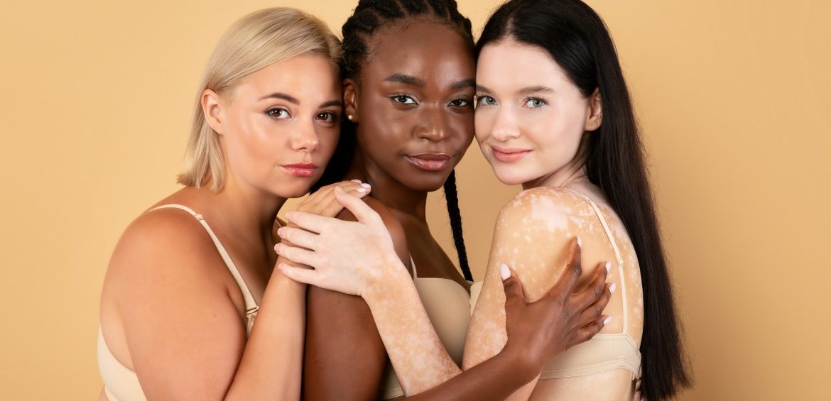 Three Multiracial Woman With Different Body And Skin Types Posing Together
